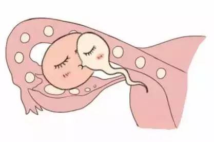 代生儿子机构